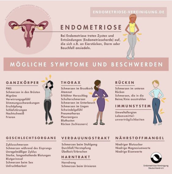 Grafik Endometriose
